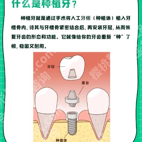 绍兴人民医院种植牙齿哪个医生好？医生擅长项目|经验丰富！