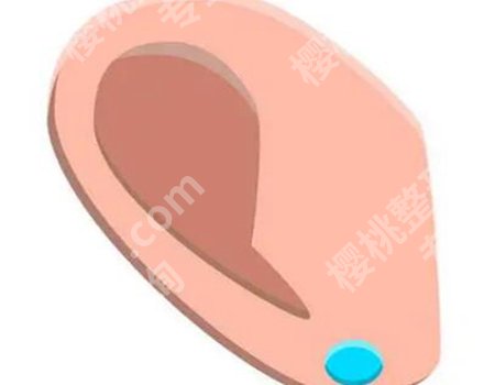 李高峰医生隆胸技术分析如何？项目介绍，坐诊医院介绍