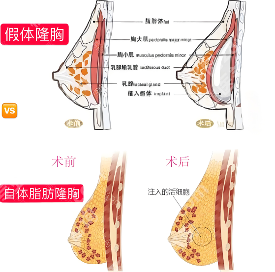 唐志荣医生隆胸技术分析如何？医生简介和口碑评价分析
