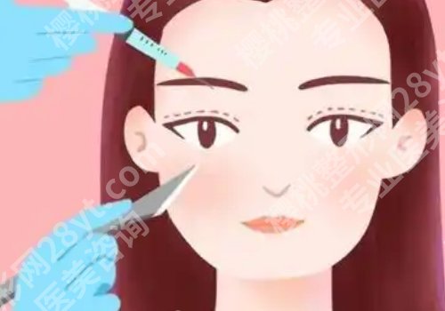 申霄医生做双眼皮修复怎么样？审美独特、技术成稳！
