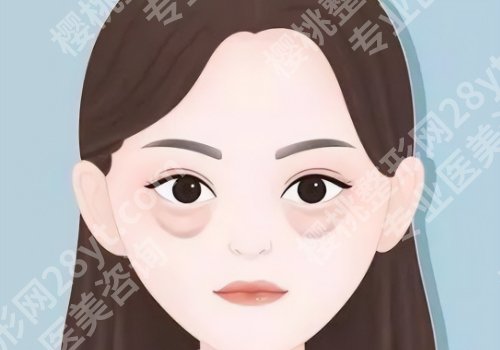 朱飞医生去眼袋怎么样？医生个人简介来袭！