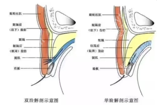 上饶割双眼皮多少钱？分享了医院推荐名单！