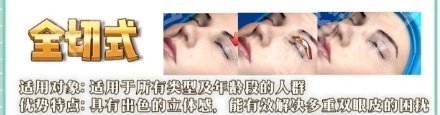 广东揭阳割双眼皮哪家医院好？一键了解医院详情信息！
