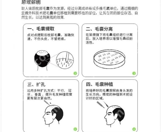 泰州植发医院哪家好？查看五家医院整体技术实力！
