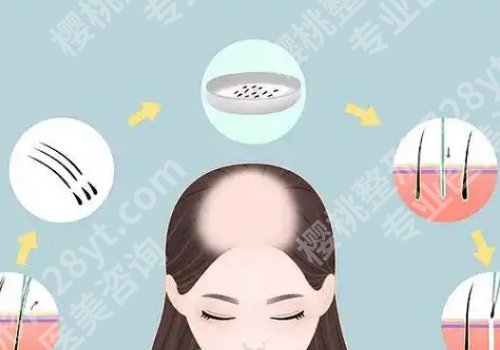 苏大附一院植发怎么样？实力强劲、医院简介来袭！
