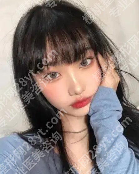 王法刚医生案例打造如何？医生实力出众、审美在线！
