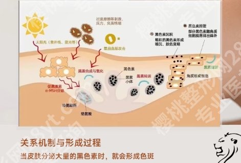 苏州哪家正规医院祛斑*好？医院实力水平出众|项目种类信息！