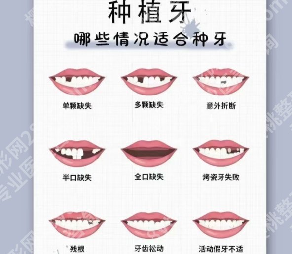 北京哪里看牙便宜又好？医院名单一览|顾客点评！