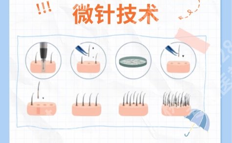 宜昌植发正规医院名单！医院技术优势|医生实力出众!