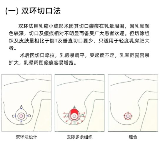 上海九院缩胸手术费用！院内人气医生简介！就诊必看！