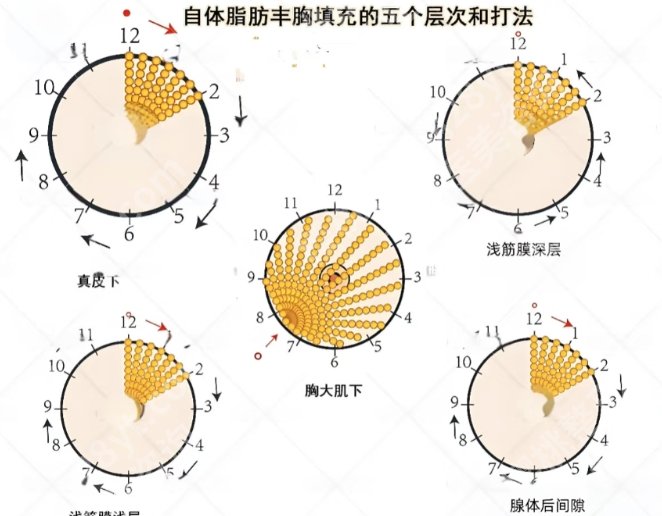 南宁抽脂隆胸多少钱？推荐几家口碑好又实惠的医院！
