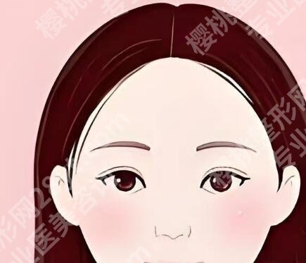 张余光双眼皮做得好吗？速看医生资料_详细案例了解