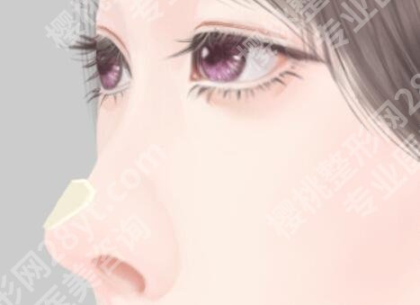 于双全鼻子做的好吗？在哪个医院工作？隆鼻价格公布