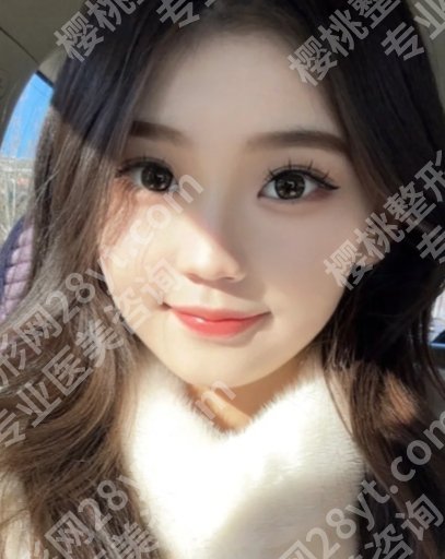 福州附属第一医院割双眼皮怎么样？医生操作娴熟、实力出众！