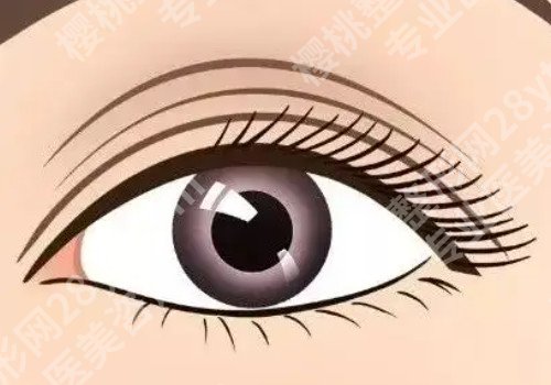 福州附属第一医院割双眼皮怎么样？医生操作娴熟、实力出众！