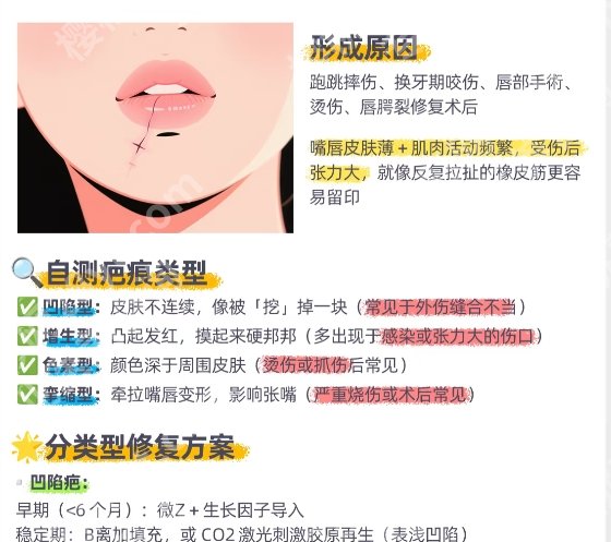 潘柏林修复唇部疤痕案例！全新价格表单附上！收藏再看！