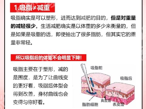 北京抽脂哪家医院比较正规？医院背景相关介绍！