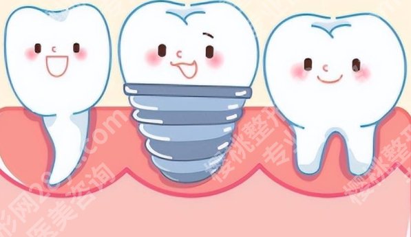 上海种牙多少钱?附医院等级|牙冠材料简介!收藏再看!