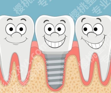 上海种牙多少钱?附医院等级|牙冠材料简介!收藏再看!
