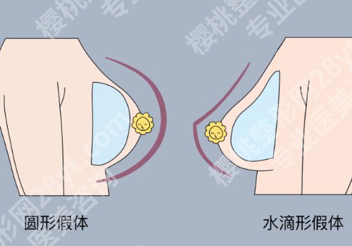 毕晔医生厉害的三个项目更新！好评在线看