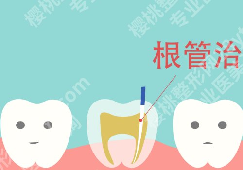 北京医院牙齿根管费用是多少？科室医生详情公开！附价格