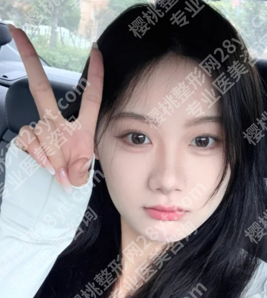 朱飞医生取鼻子怎么样啊？风格技术评析！戳进来看