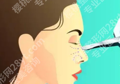顾钏医生手术排队多久？医生实力怎么样？一篇文章告诉你