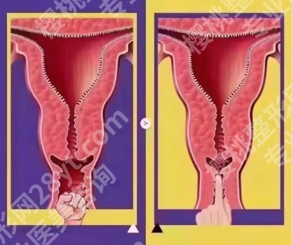 重庆军科的紧缩针可以打吗？医院基本信息|案例图展示！