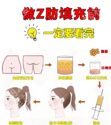 上海华美自体脂肪填充怎么样？做填充案例及术后tips分享！