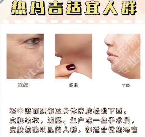上海艺星热玛吉多少钱？医院基本信息！价格收费参考