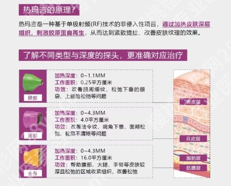 上海艺星热玛吉多少钱？医院基本信息！价格收费参考