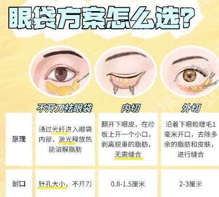 301医院整形科割眼袋多少钱?医院项目技术好|口碑不错!