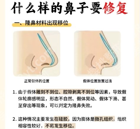 北京八大处鼻修复专家名单！医院具体简介|案例分享！