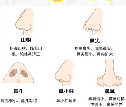 山东省立医院假体隆鼻多少钱？附真人隆鼻案例图反馈！