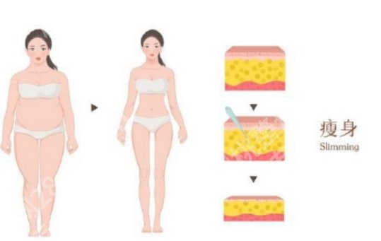无锡吸脂专家排名前十榜单更新！个个实力口碑兼具！