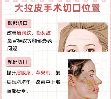 南方医院拉皮手术好吗?医院简介|核心项目|技术优势点评！