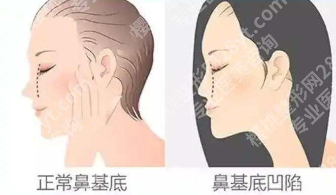 上官文松做鼻子怎么样？医生技术盘点|具体相关内容介绍！