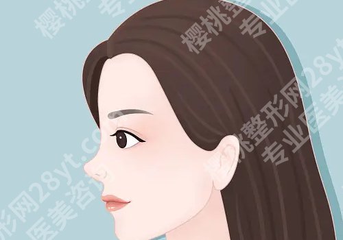 李东医生在院整外科的地位与口碑评价咋样？附隆鼻案例新鲜出炉！