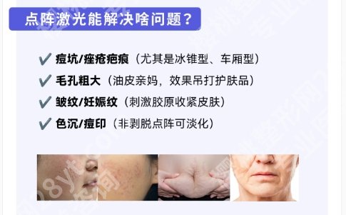 长春吉大二院点阵激光多少钱?医院物美价廉|医生名单揭秘!