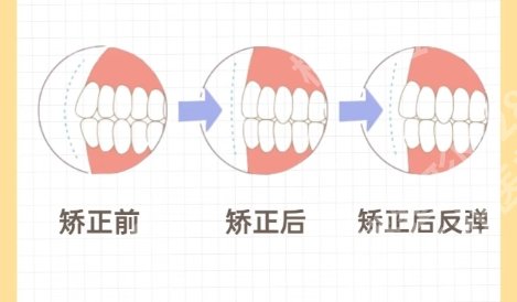 南昌一附院牙齿矫正多少钱?医院项目详情|用户口碑参考!