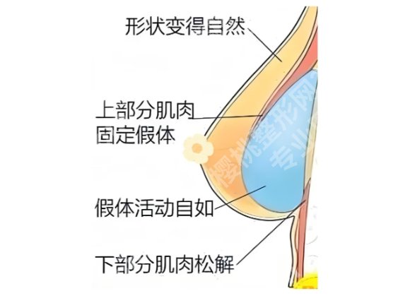 何金光医生假体隆胸多少钱?2025*新价格表参考!