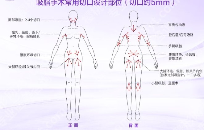 长春吸脂做得好的专家！盘点医生top5名单！点击收藏