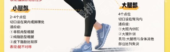 烟台大腿吸脂哪里好？医院反馈|口碑良好！速速码住