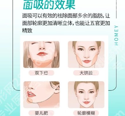 北京做面部吸脂有名的医院！来看看有没有你心仪的医院！