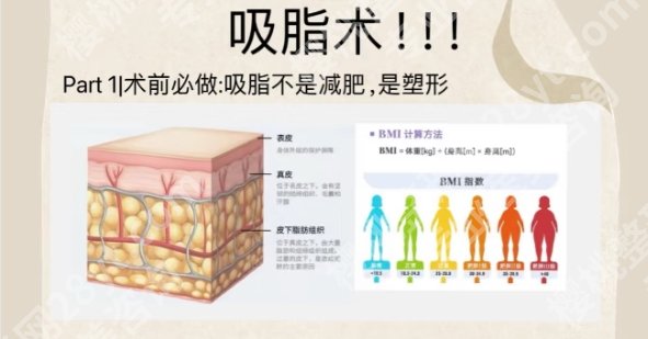泉州吸脂专家排名名单！医生名单揭秘！就诊必看