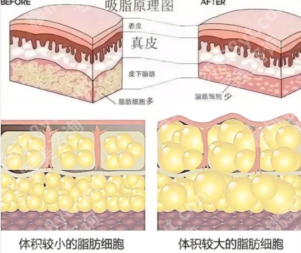 天津吸脂好的医院排名！医院经验丰富|特色项目参考！
