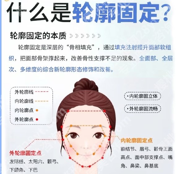 成都做轮廓固定哪家好？附术后注意事项相关简介！