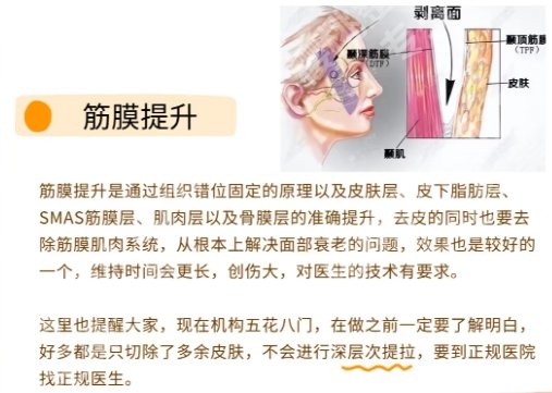 唐都医院筋膜悬吊价格2025曝光！25000元起，附项目知识科普！