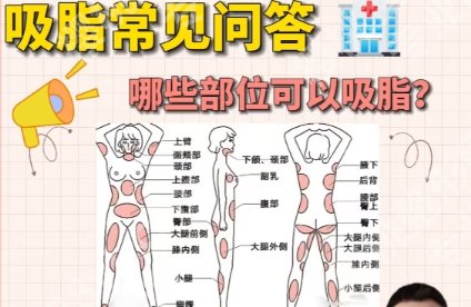 张让虎吸脂野生案例图一览！见证美丽蜕变！附2025收费价格表