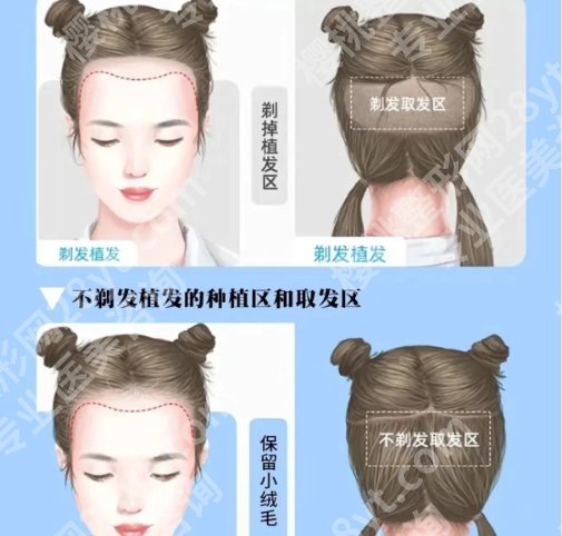 大同植发医院有哪些？25全新医院排行榜大盘点！